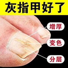 【医师推荐】灰指甲治疗特效液去除增厚亮甲灰甲修复液专用抑菌液